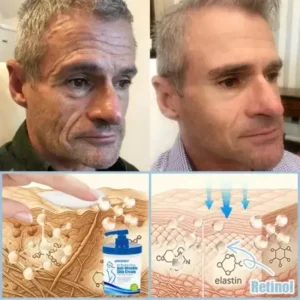 Anti-Wrinkle Skin Cream