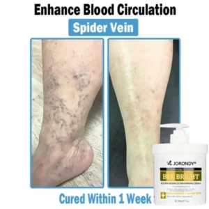 Bee Bright Multi-Symptom Skin Treatment Cream