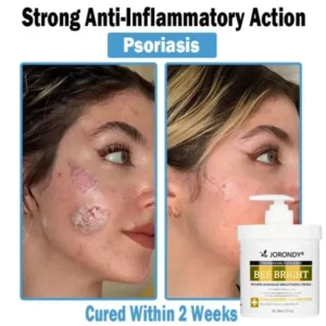 Bee Bright Multi-Symptom Skin Treatment Cream