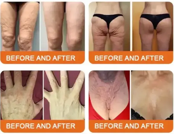 Bee Toxin Lift Cream