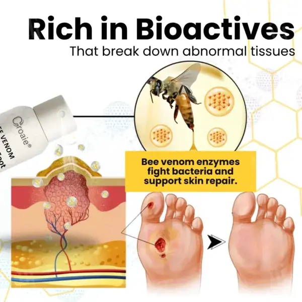 Bee Venom Diabetic Foot Ulcer Spray