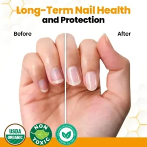 BeeVenom Anti-Fungal Nail Renewal Oil