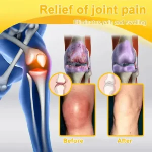 Botulinum Toxin & Bee Venom Pain-Relief Bone Healing Cream