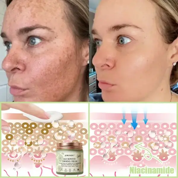 Firming Cream——Visibly Firms in Just 21 Days – Without Surgery or Irritation
