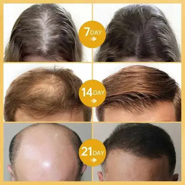 Hair Growth Essence