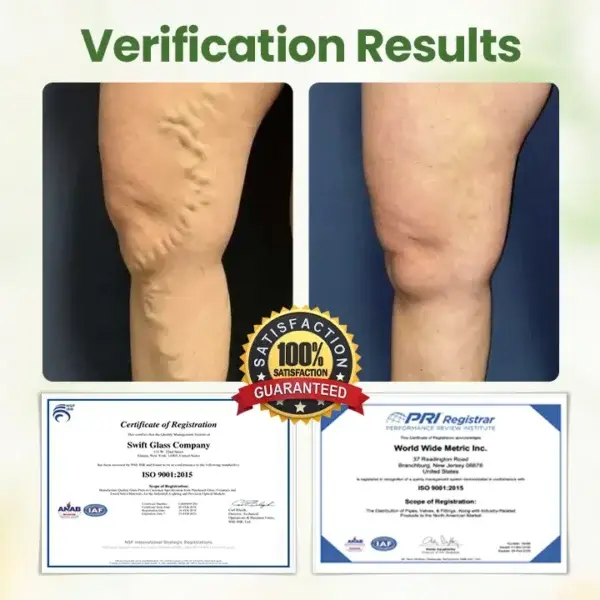 Lymphatic Detox Herbal Cream