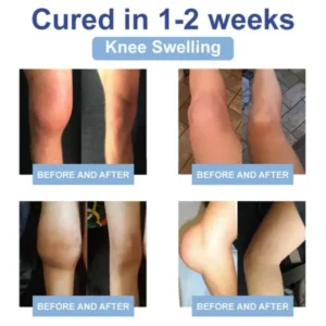 Magnesium Pain Healing Bone Cream