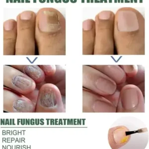Nail Repair Serum