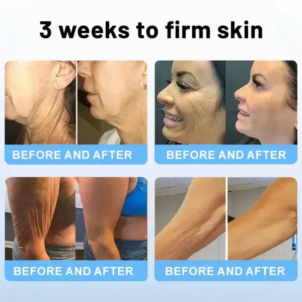Oligopeptide-Infused Skin Firming Cream
