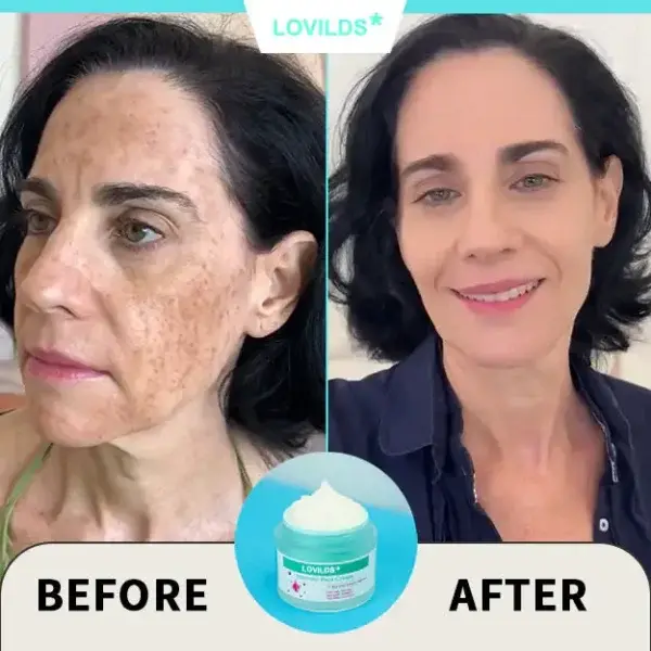 Renewal Skin Cream