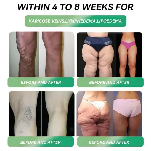 Slimming Oral Solution