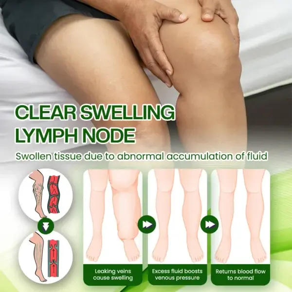SwellRelief Horse Chestnut Edema Cream