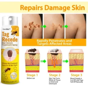TagRecede Bee Venom Treatment Spray
