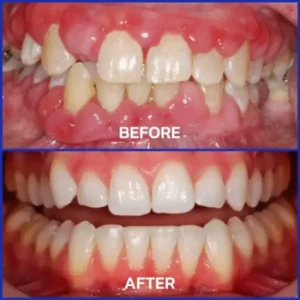VioGloss Bienengift-Zahntherapie Oral Power