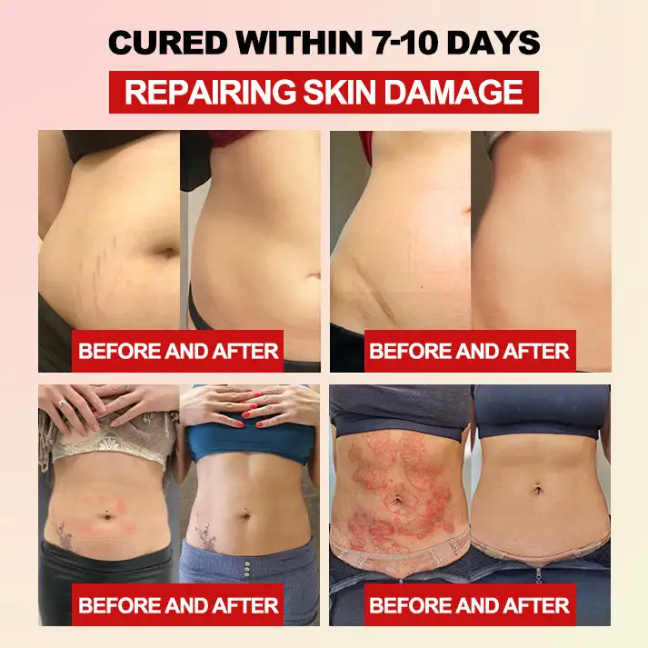 𝐅𝐢𝐛𝐞𝐫 𝐚𝐧𝐝 𝐖𝐨𝐫𝐦𝐰𝐨𝐨𝐝 𝐁𝐨𝐝𝐲 𝐒𝐡𝐚𝐩𝐢𝐧𝐠 𝐖𝐚𝐢𝐬𝐭 𝐏𝐫𝐨𝐭𝐞𝐜𝐭𝐨𝐫 - Image 5