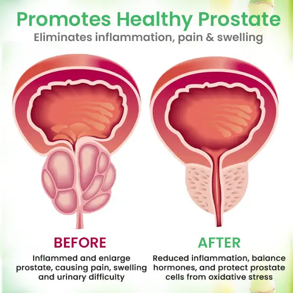 Detox Prostate Care Patch - Image 5