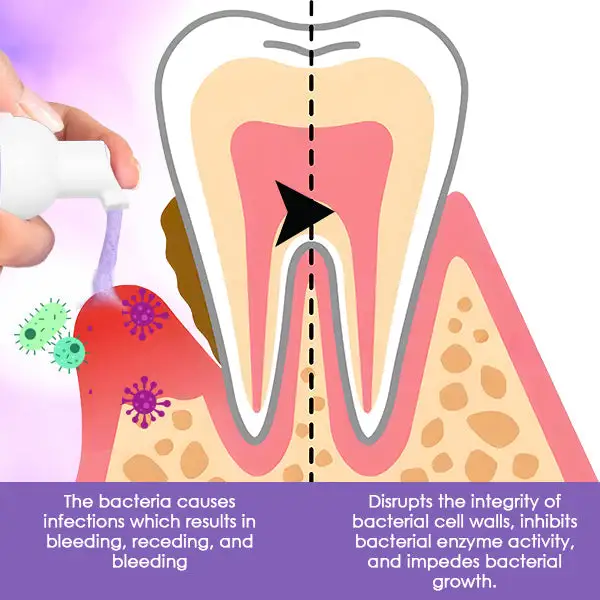 Gum Treatment Foam - Image 5