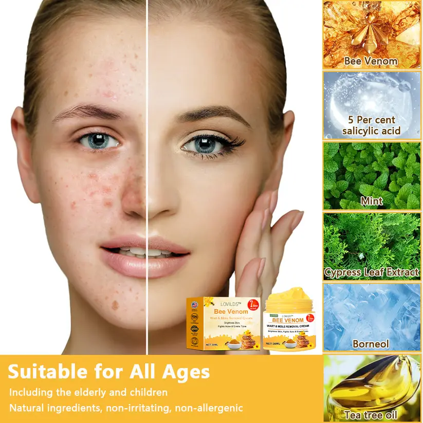 Bee Venom Wart & Moles Removal Cream - Image 2