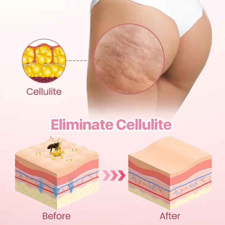 ButtMax+ Bee Venom Butt Enhancer Cream - Image 4