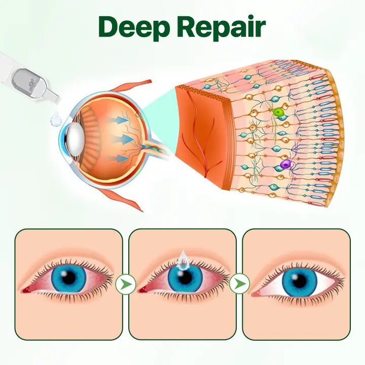 Vision Enhancing Multifunctional Eye Drops - Image 6