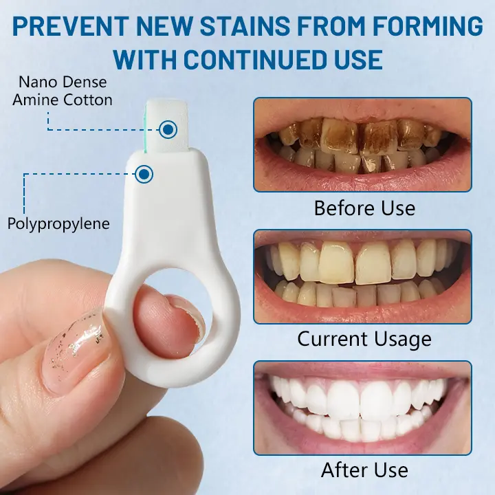 Highly effective tooth stain cleaner - Image 5
