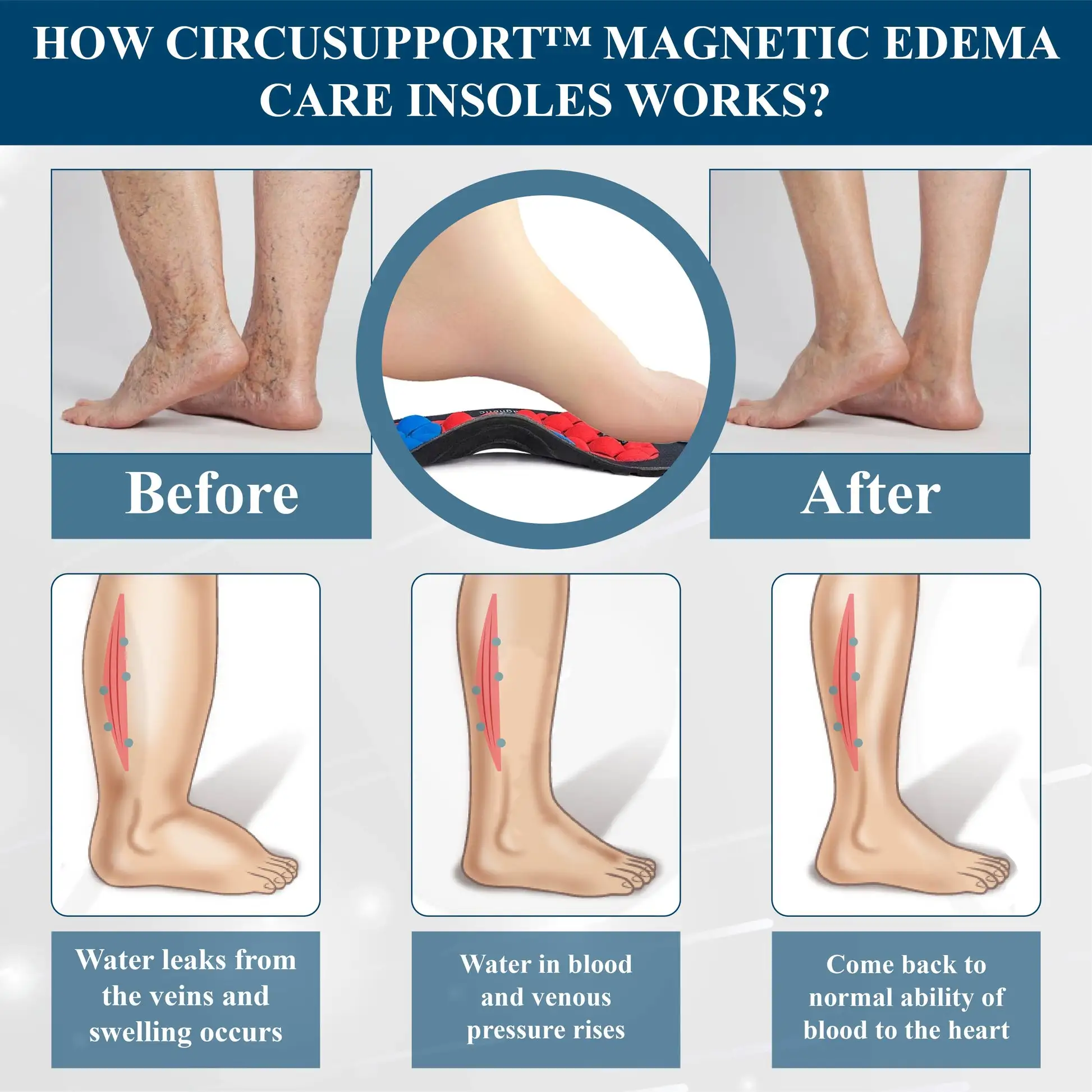 Magnetic EdemaCare Insoles - Image 7