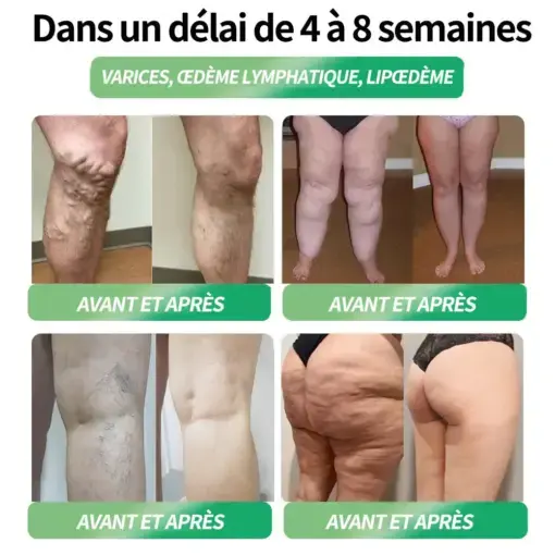 Solution orale Telportide - Image 4