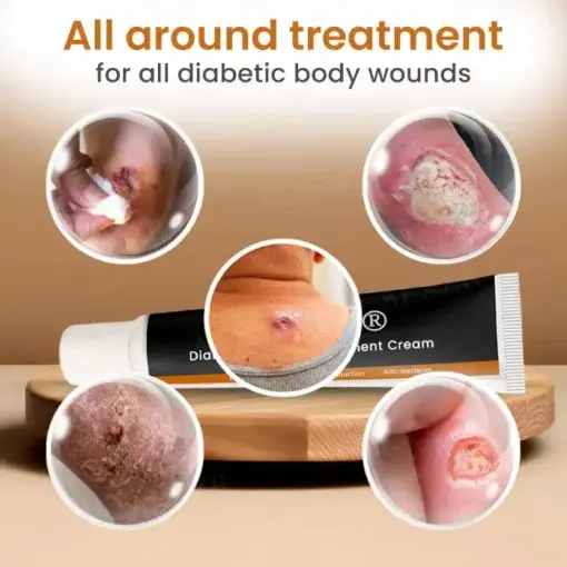 Diabetic Wounds Treatment Cream - Image 6