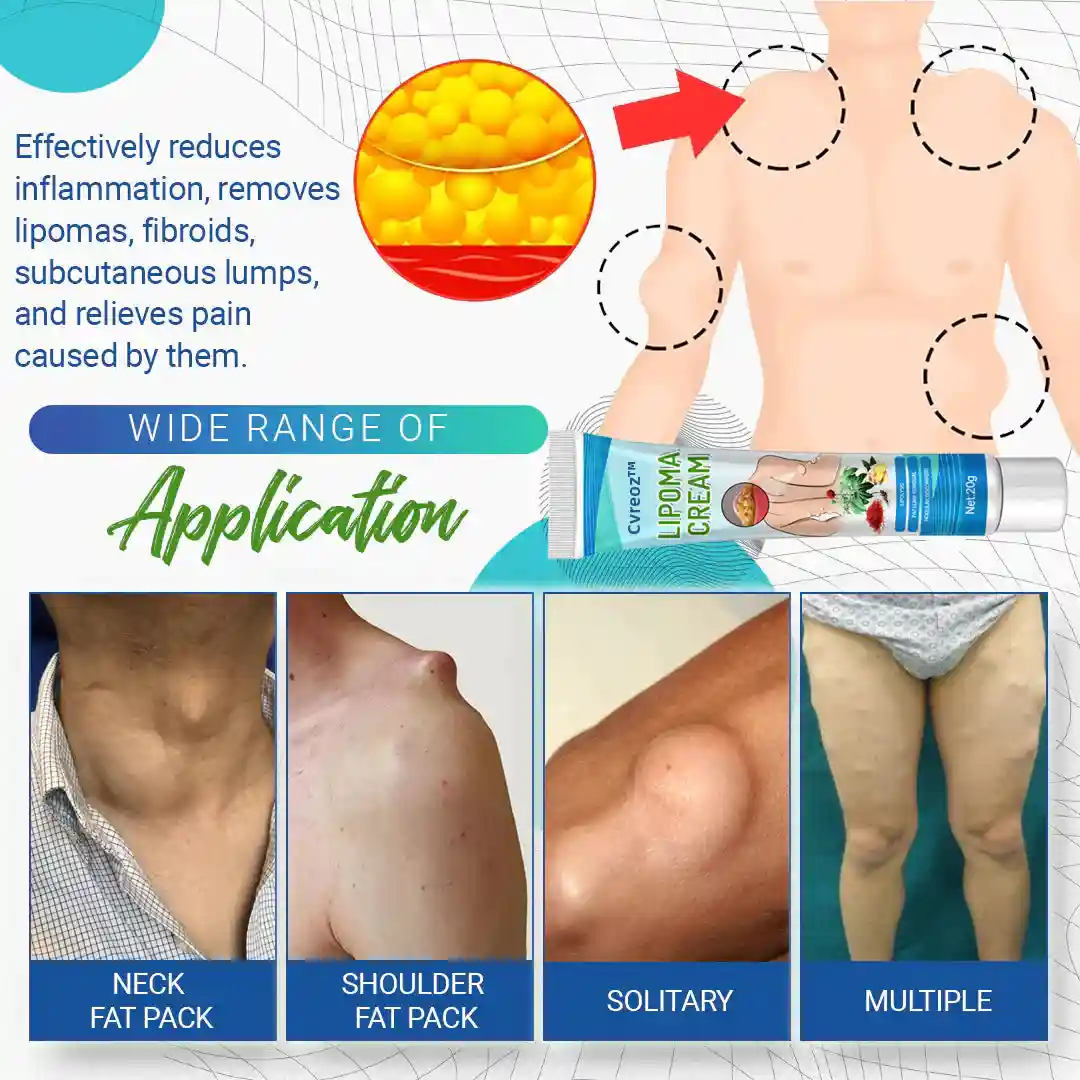 Cvreoz Lipoma Removal Cream - Image 8