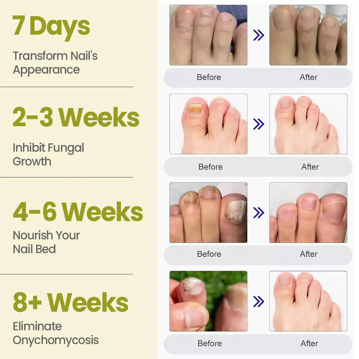 Nail Fungal Patches Pro+ - Image 5