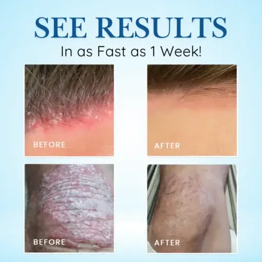 Source-Relief Magnesium Spray - Image 2