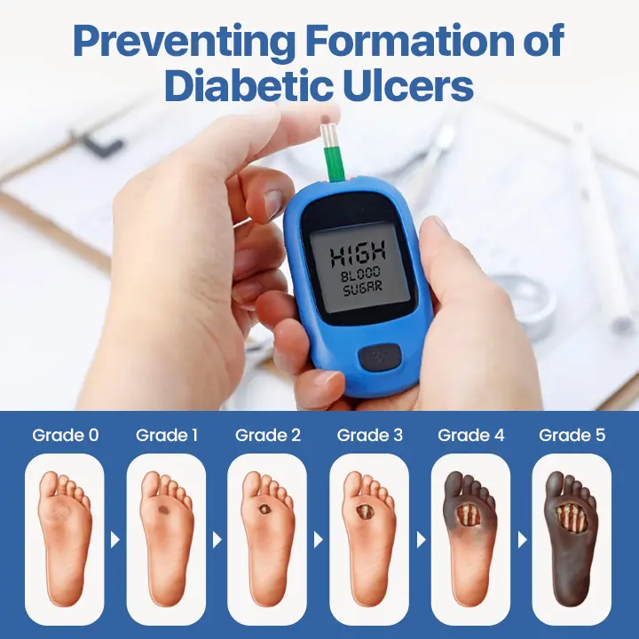 VitaGluco Diabetes Treatment Cream Heal Diabetic Wounds Faster & Safer - Image 2