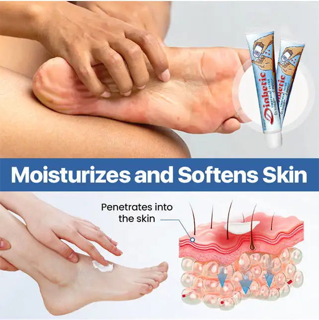 VitaGluco Diabetes Treatment Cream Heal Diabetic Wounds Faster & Safer - Image 5