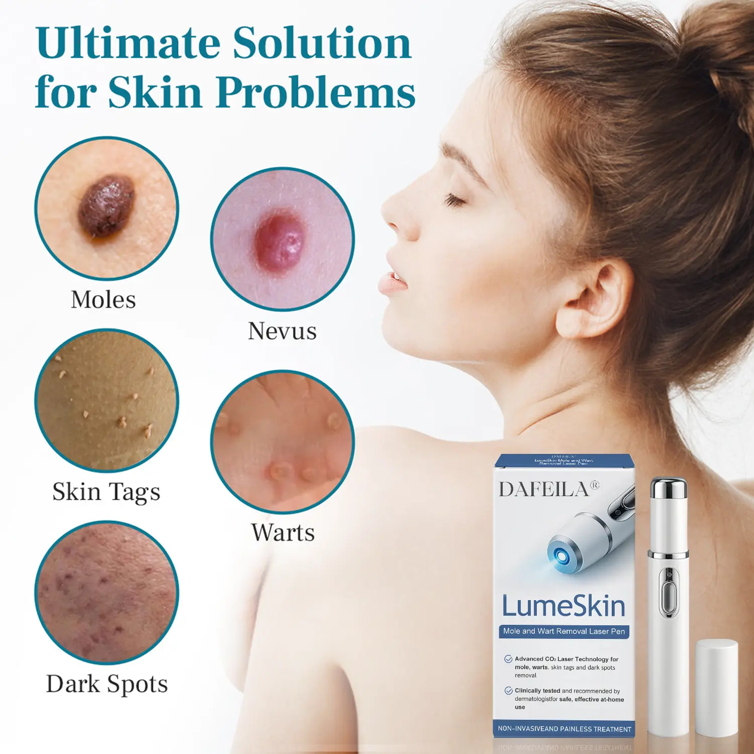 LumeSkin Mole and Wart Removal Laser Pen - Image 8