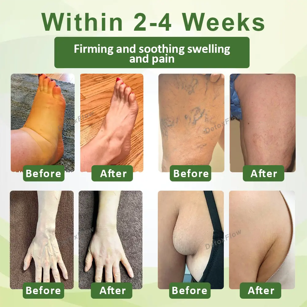 Advanced SwellCare Lymphatic Cream - Image 2