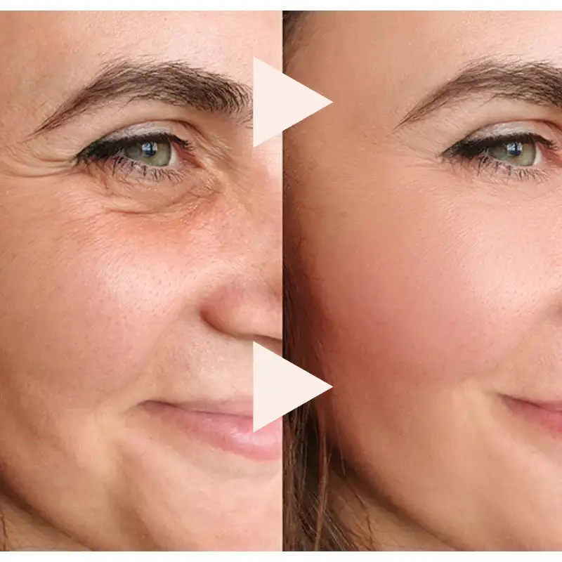 The Express Anti-Wrinkle – Instant Lifting Effect - Image 3