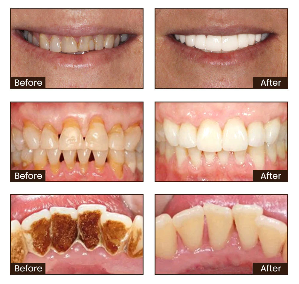 Niacinamide Whitening Toothpaste - Image 3