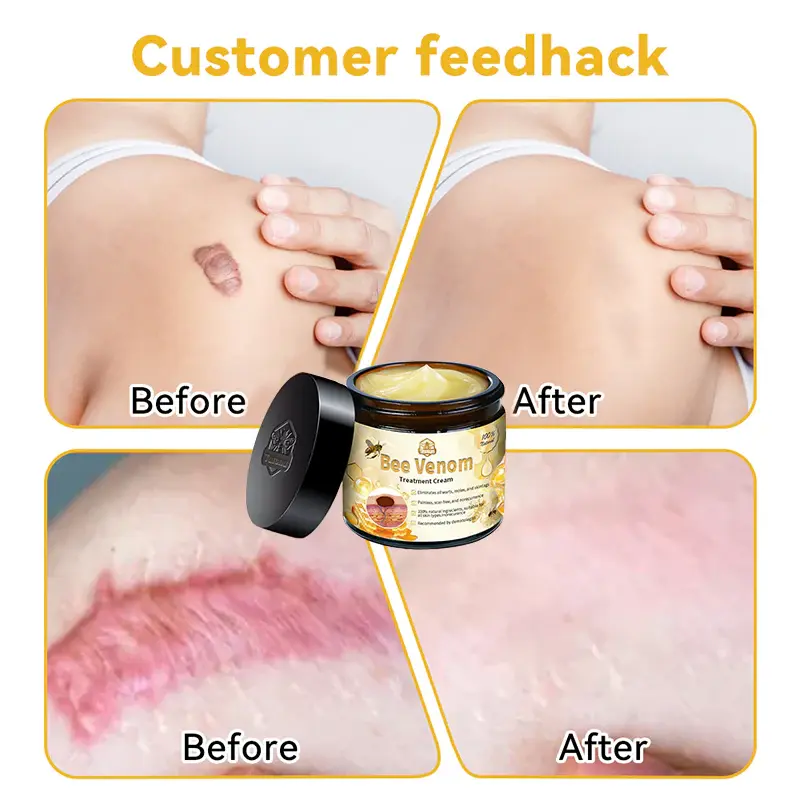 Bee Venom Skin Treatment Cream - Image 9