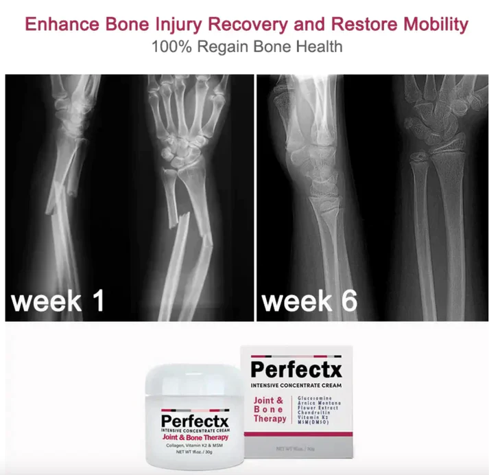 Perfectx Joint And Bone Therapy Cream - Image 5
