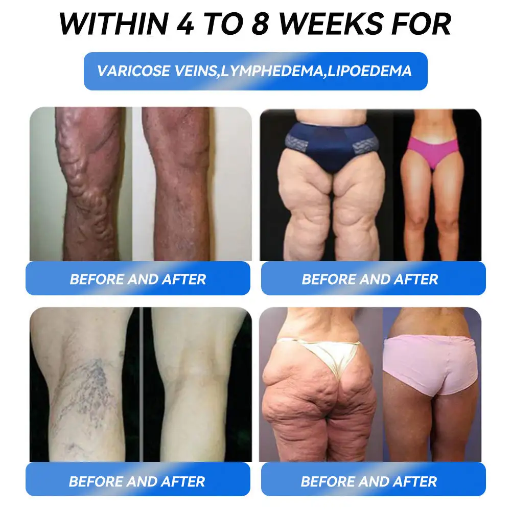 Weight Loss Oral Solution - Image 5