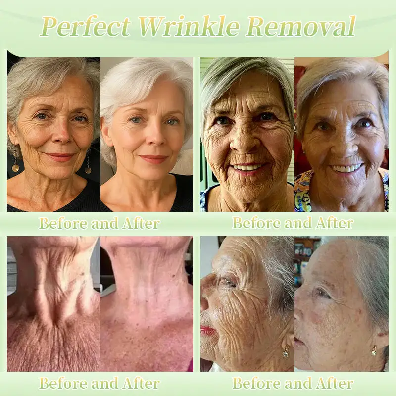 Firming Cream——Visibly Firms in Just 21 Days – Without Surgery or Irritation - Image 2