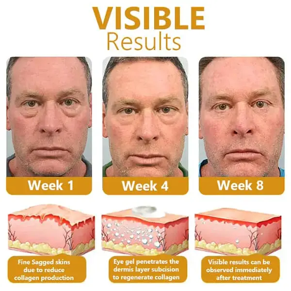 Bee Venom Awakening Peptide Eye Lifting Gel - Image 6