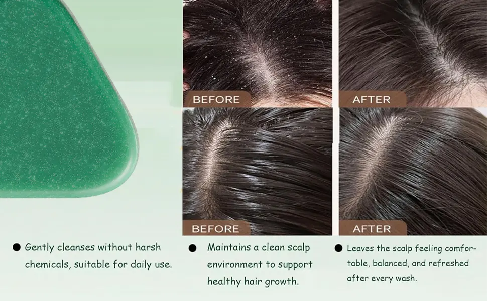 2-in-1 Herbal Shampoo Bar - Image 5