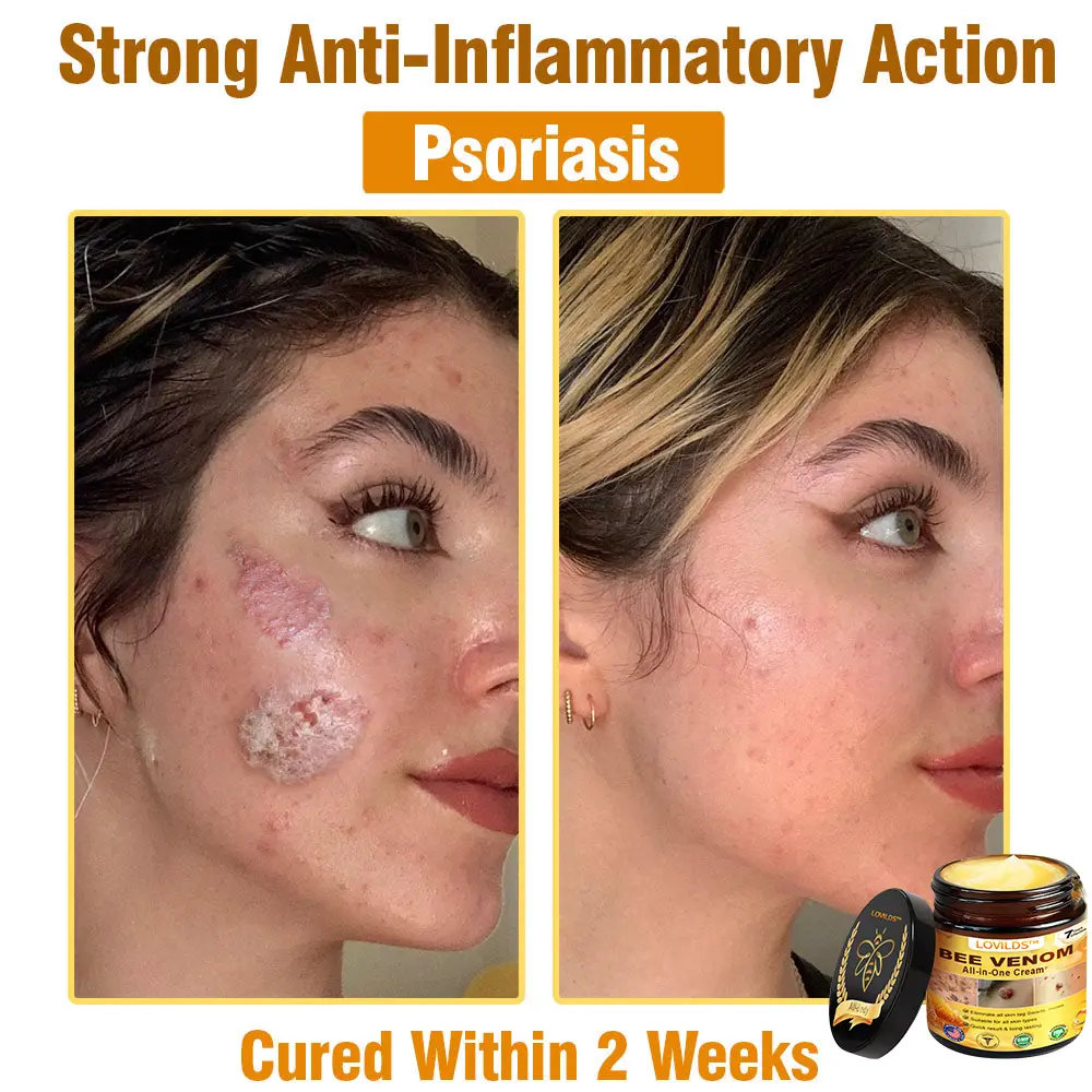 Bee Venom All-in-One Cream US Dermatologist Approved - Image 10