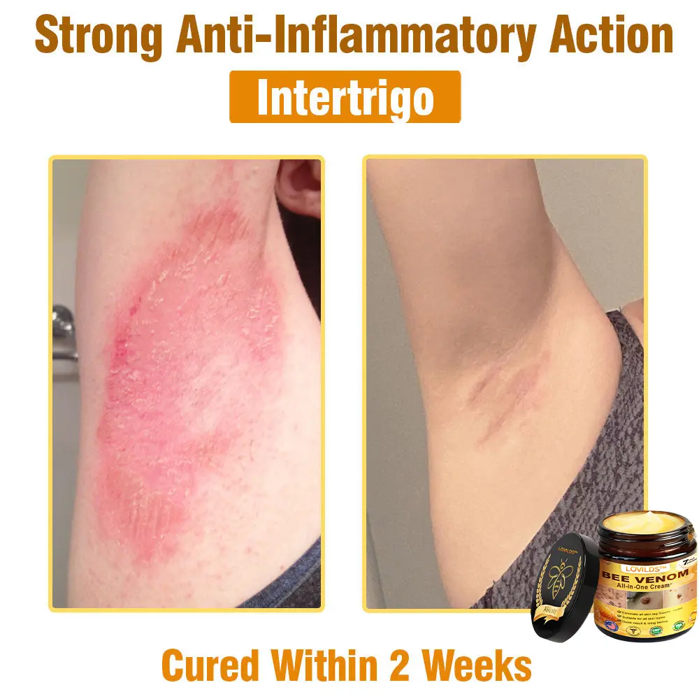 Bee Venom Cream – Anti-Aging Hydrating & Skin Repair - Image 10