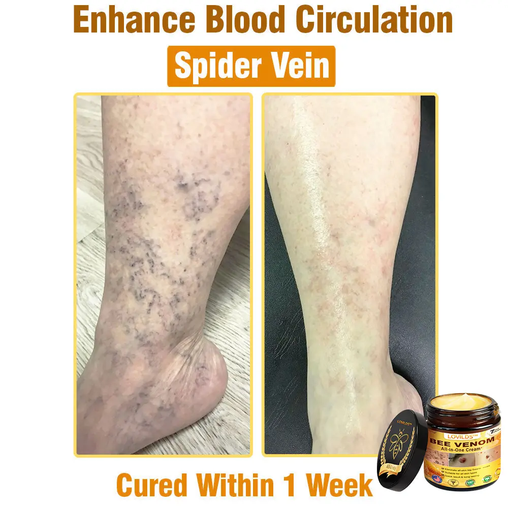Bee Venom Cream – Anti-Aging Hydrating & Skin Repair - Image 12