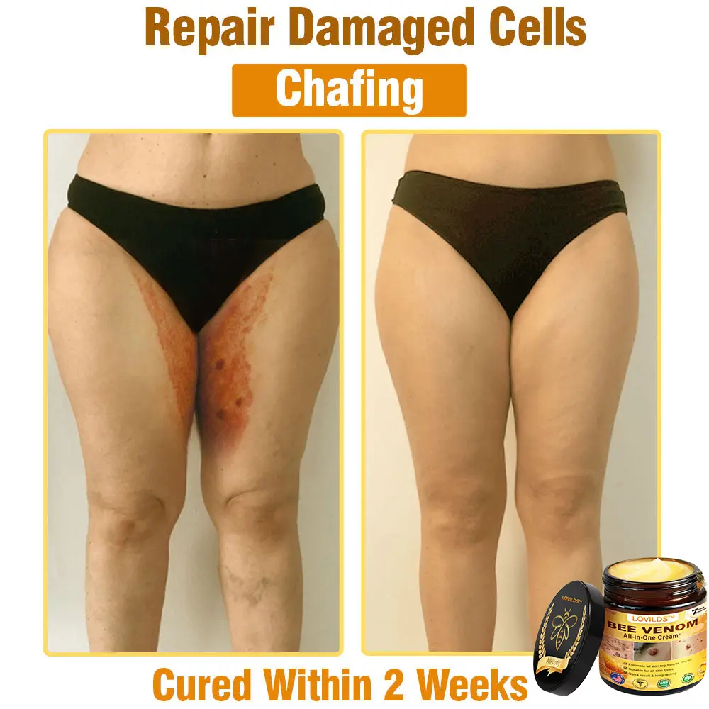 Bee Venom Cream - Image 13