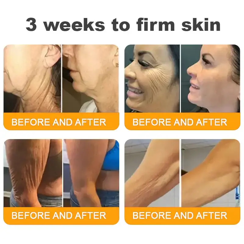 Bee Venom Cream - Image 6