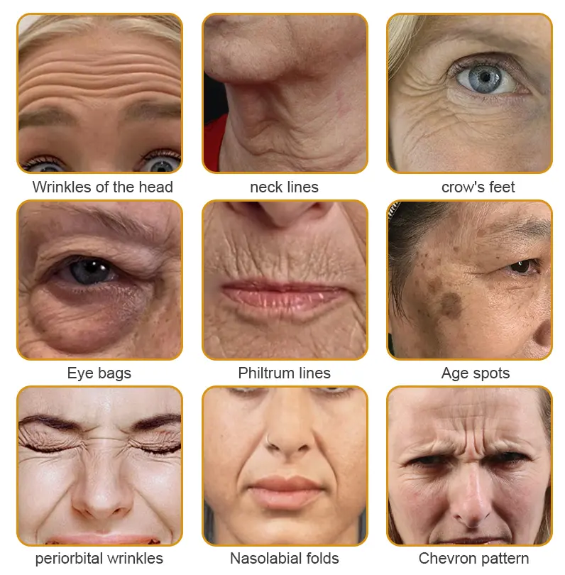 Botulin Bee Poison Wrinkle Removal Cream - Image 2