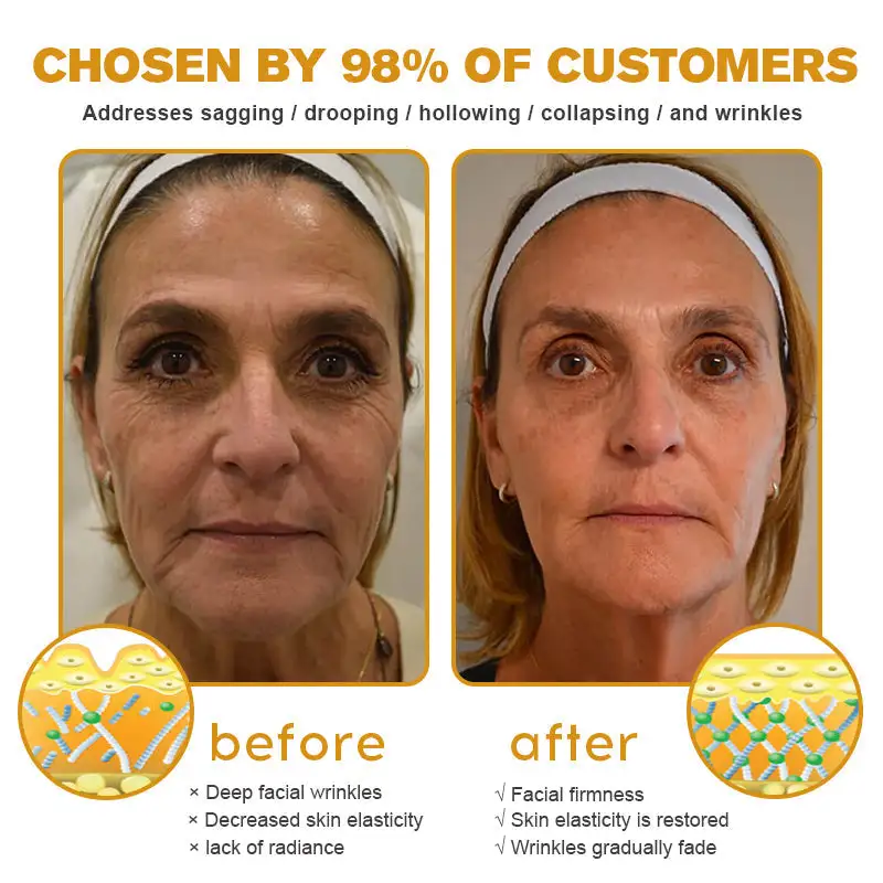 Botulin Bee Poison Wrinkle Removal Cream - Image 7